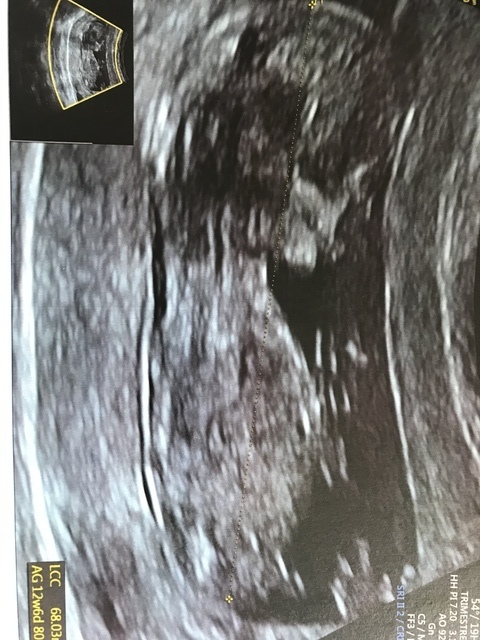 9943AF3D-6B9B-4DC6-9561-8E9716FFC649.