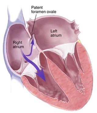 coeur foetale