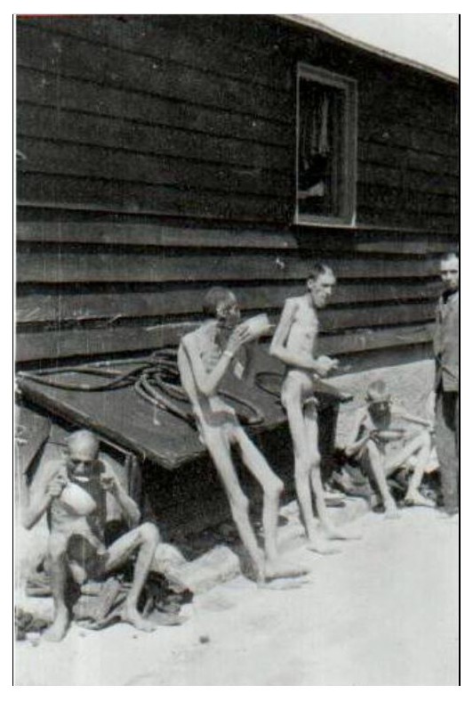 Camp de concentration de Mauthausen Ds6GNb-survivant-cadaverique